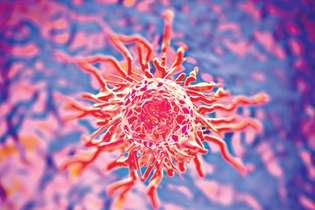 O câncer é o crescimento anormal e desordenado de células e pode ocorrer em qualquer parte do corpo humano