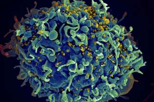 Anticorpos são 'treinados' contra HIV
