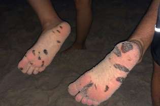 O humorista Whindersson Nunes pediu para tirar foto dos pés sujos de óleo de um casal de fãs que encontrou na praia