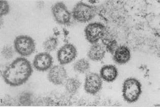 Arenavírus detectado em Serra Leoa, aparentado do encontrado em Sorocaba, São Paulo