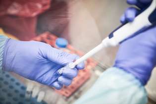 Teste é o de RT-PCR, o mais indicado para o diagnóstico da doença.