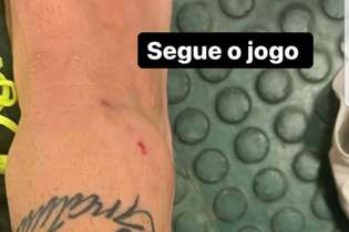 Guilherme Arana postou uma foto do seu pé após o jogo