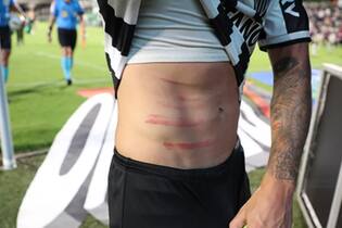 Lateral Guga mostra barriga arranhada pelas travas da chuteira de Danilo Barcelos