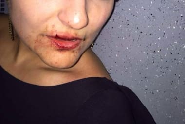 Médica sofreu corte no lábio superior com o soco desferido pelo policial